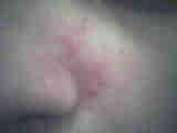dermatoses et soins dermatoses et soins