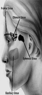Sinus - Sinusite