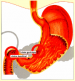 75px Ulcere gastro duodenal - Tous les articles de Gastrologie