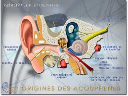 341 - Atteintes auditives de l'oreille interne : Acouphènes