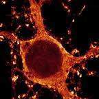 239 - Les modifications structurales : La synaptogénèse