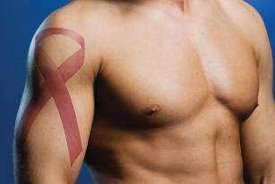 Cancer du sein chez l homme