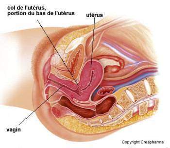 Le cancer du col de lutérus - Le cancer du col de l&#039;utérus