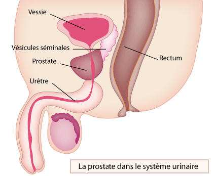leukocyták és prostatitis ez az ital a prosztata gyulladásakor