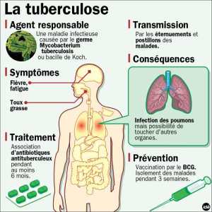 Comment-reconnaître-une-tuberculose