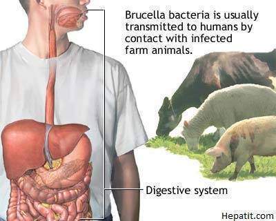 Les infections alimentaires La brucellose - Les infections alimentaires : La brucellose