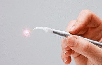 La-laser-chirurgical-remplace-le-bistouri-et-evite-de-saigner