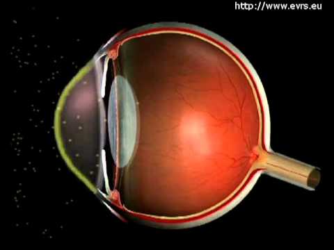 La vision - evrs